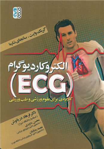 الکتروکاردیوگرام (ECG)