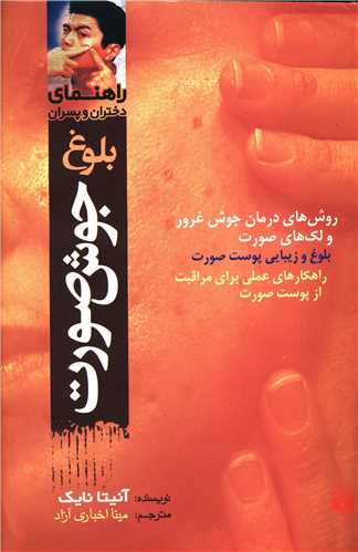 راهنمای دختران و پسران (جوش صورت)